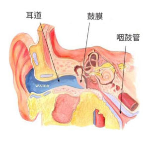 耳朵進水
